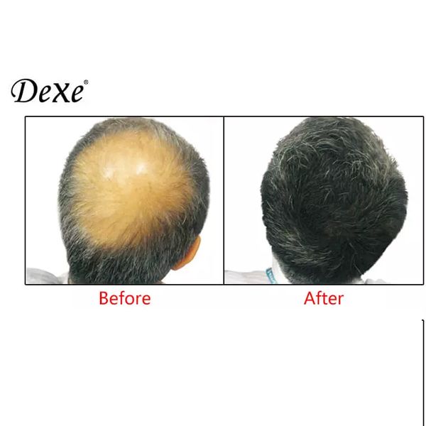 Dexe Hair Building Fibers Black caboki