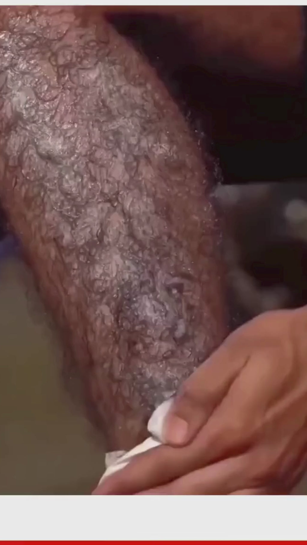 New Original Ecrin Hair Removal Foaming Spray Advance Formula with Refreshing Fragrance 200ml